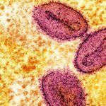 Rki Meldet Ersten Nachweis Von Neuer Mpox Variante In Deutschland