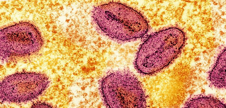 Rki Meldet Ersten Nachweis Von Neuer Mpox Variante In Deutschland